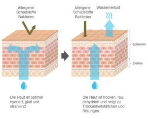 Hautschutzbarriere